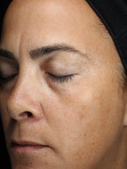 Image of face before using product